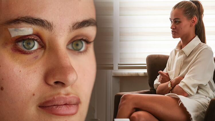 Ukraynalı model Daria Kyryliuk darp iddiasıyla ilgili konuştu