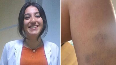 Kovid-19 hastası ‘Bana bakmak zorundasın’ diyerek doktora saldırdı