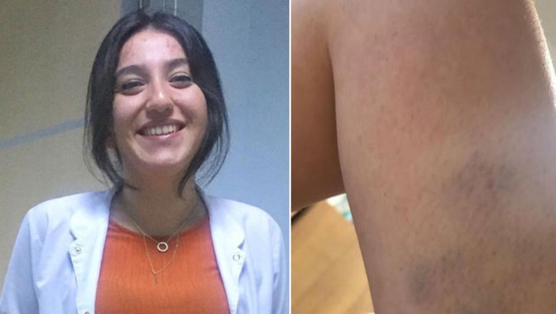 Kovid-19 hastası ‘Bana bakmak zorundasın’ diyerek doktora saldırdı