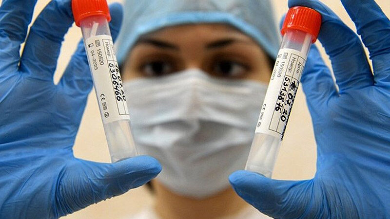 İkinci koronavirüs dalgası kapıda mı? Koronavirüs pandemisi dünyayı hazırlıksız yakaladı. Çok sayıda ülke enfeksiyonun yayılmasını