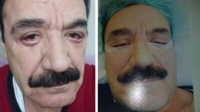 Doktor, ‘Yakışıklısın, gel senin yanaklarını geriye doğru alalım’ dedi, hayatının şokunu yaşadı