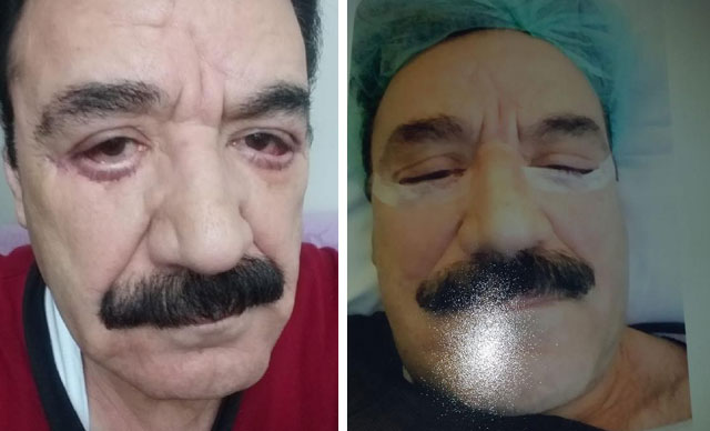 Doktor, ‘Yakışıklısın, gel senin yanaklarını geriye doğru alalım’ dedi, hayatının şokunu yaşadı