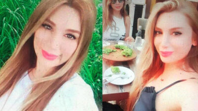 Botoks sonrası ölümde şoke eden iddia