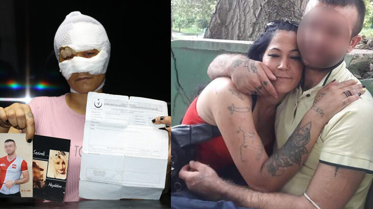 ‘Rüyalarıma giriyor, psikolojim altüst oldu’