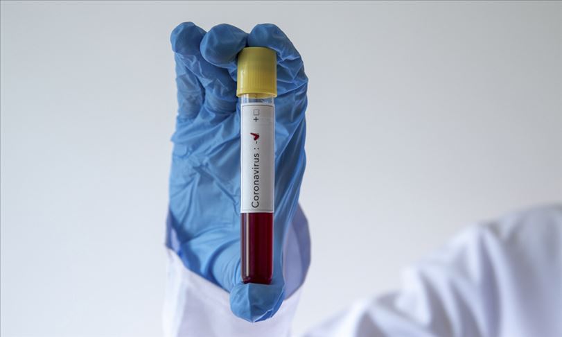 TOFAŞ’ta koronavirüs şoku TOFAŞ’ta koronavirüs şoku