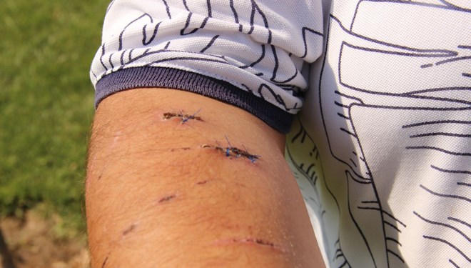 Otelde ‘Pitbull’ dehşeti!