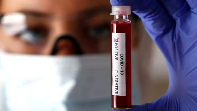 Koronanın etkilerini hafif ya da şiddetli atlamanızı kan grubu belirliyor Koronanın etkilerini hafif ya da şiddetli atlamanızı kan grubu belirliyor