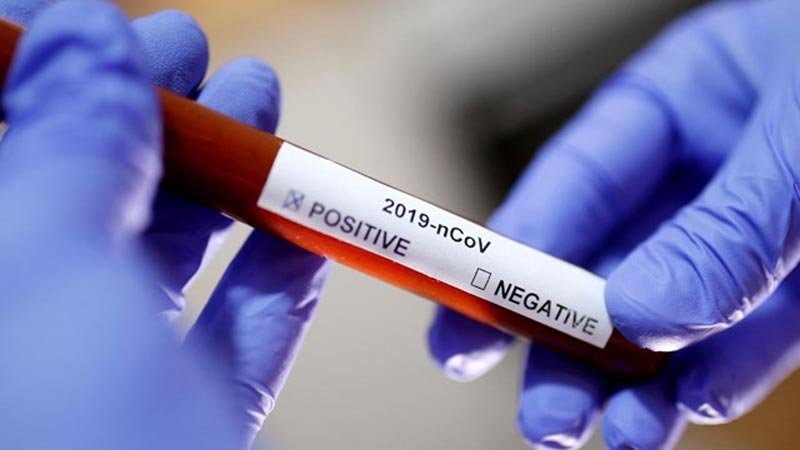 Vali Avni Çakır koronavirüse yakalandı