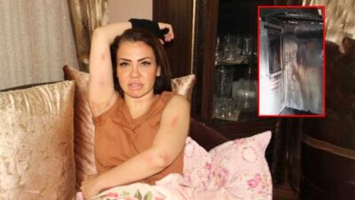 Başı beladan kurtulmuyor! 2 ay önce ölümden dönen şarkıcının bu kez de evi küle döndü