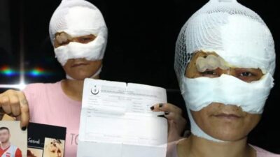 Metruk evde işkence ve tecavüz! 2 çocuk annesi kadın dehşeti anlarını anlattı