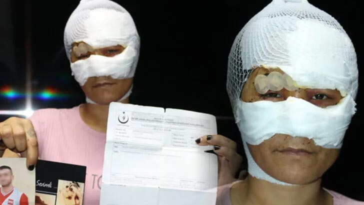 Metruk evde işkence ve tecavüz! 2 çocuk annesi kadın dehşeti anlarını anlattı