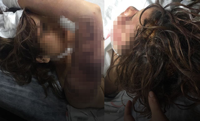Dehşet odası! Zincirle dövüp, tırnaklarını çekerek işkence yaptı