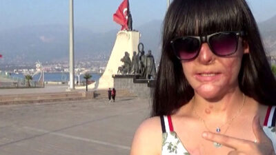 Yüzüne asit atan saldırganı affeden Berfin: Bu karardan çok pişmanlık duydum