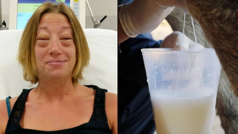 Eşek sütü içti, ölümden döndü