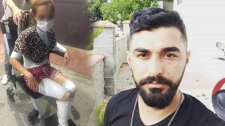 Kızgın bıçakla eşinin vücudunu dağlayan cani koca yakalandı!