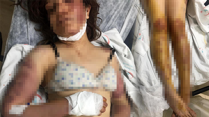 2,5 yıldır işkence! Vahşetin ayrıntıları ortaya çıkıyor