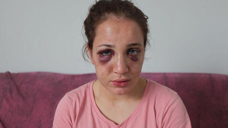 Her satırı kabus! ‘Aldattığını öğrenince saatlerce dayak yedim’