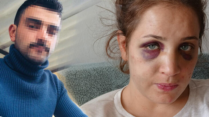 Eşine uyguladığı şiddeti ‘gururla’ anlatıyordu… Cezası belli oldu