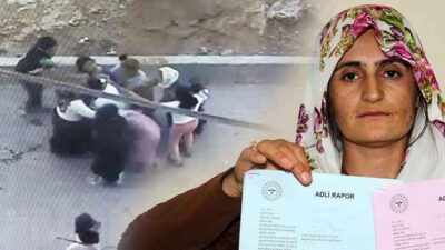 Genç kadın komşuları tarafından darp edildi! Beni öldüreceklerdi