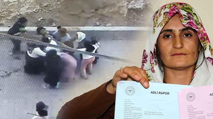 Genç kadın komşuları tarafından darp edildi! Beni öldüreceklerdi