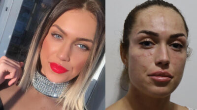 Kabusu oldu! ‘Yüzüm komple şişti, nefes alamadım’