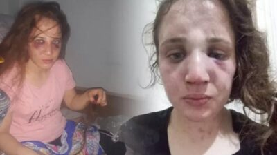 Her gün darp edilip işkenceye maruz kaldı! Yetkililerden yardım istedi