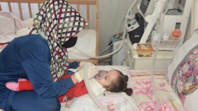 Bursalı küçük Eda tedavi için yardım bekliyor