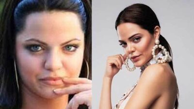 Ağzınız açık kalacak! Ünlülerin estetiksiz halleri…