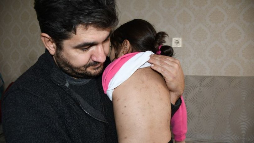 Berra’yı 100 saçmayla yaralamışlardı! İşte verilen ceza