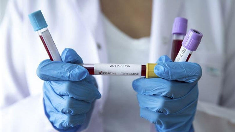 Adanaspor’da koronavirüs şoku! 3 futbolcu pozitif Adanaspor’da koronavirüs şoku! 3 futbolcu pozitif