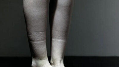 Bacaktaki bu iz her şeyi açıklıyor!