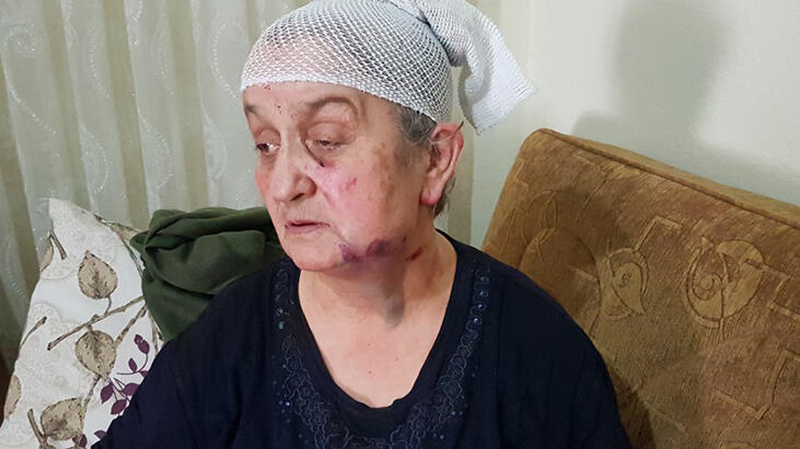 ‘Pes artık’ dedirten olay! Ölü taklidi yaparak, kurtuldu!