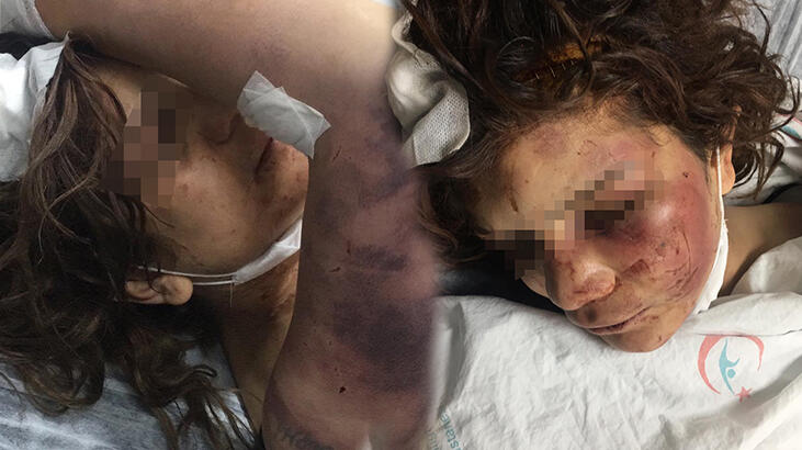 Birlikte yaşadığı kadına işkence eden sanığa 34 yıla kadar hapis istemi