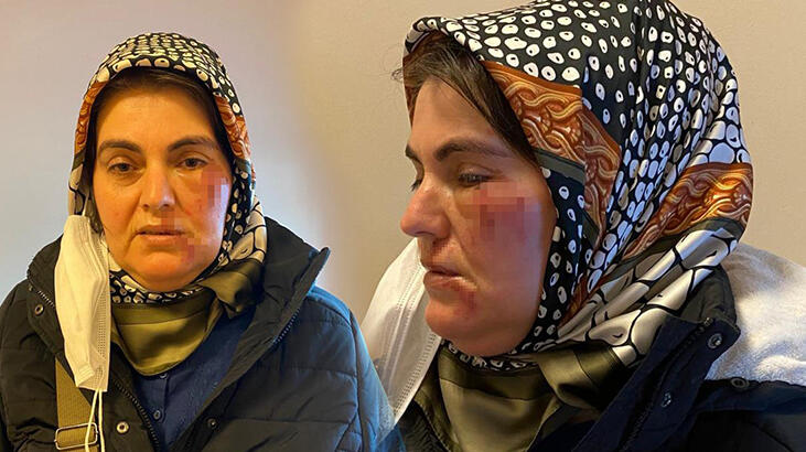 Korkunç olay! Sokak ortasında tanımadığı kişinin saldırısına uğradı