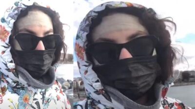 Ünlü oyuncunun estetik acısı: Bilsem kalkışmazdım