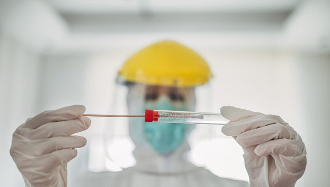 Bilim Kurulu Üyesi’nden 6 gün uyarısı: Doğru sonuç vermez