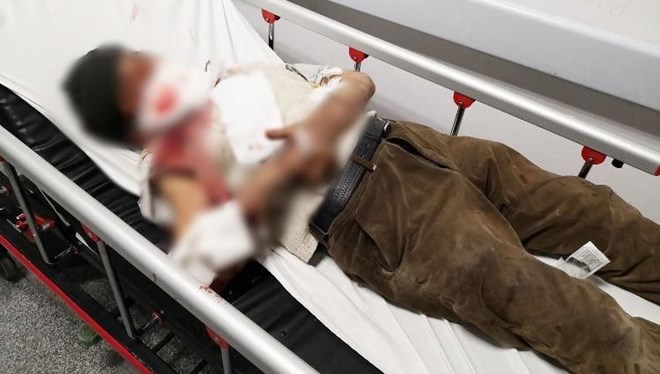 Misafirliğe gitti, dehşeti yaşadı