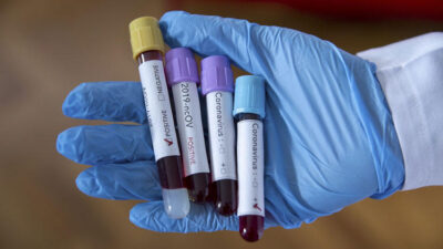 2 kardeş aynı gün koronavirüsten öldü