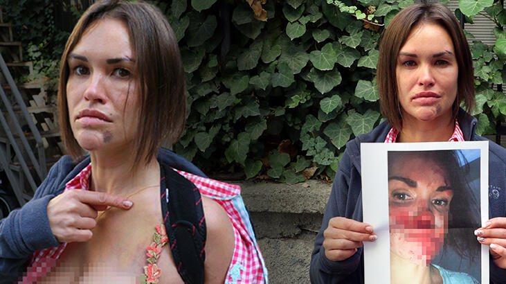 Rus Vera bu fotoğraflarla belgelemişti! Ölü bulundu