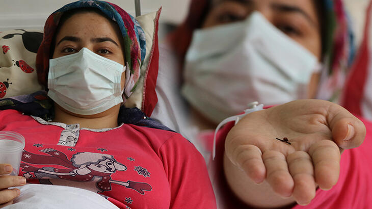 Bebekken yuttuğu toplu iğneden 17 yıl sonra kurtuldu