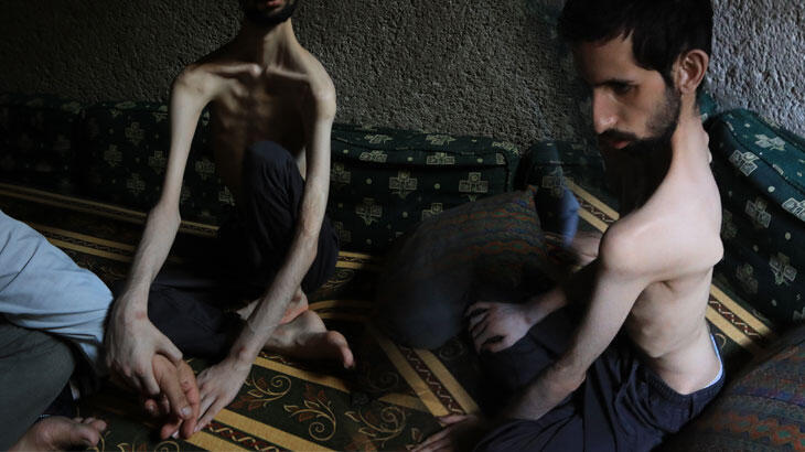 35 kiloya kadar düşmüştü! İnanılmaz değişim