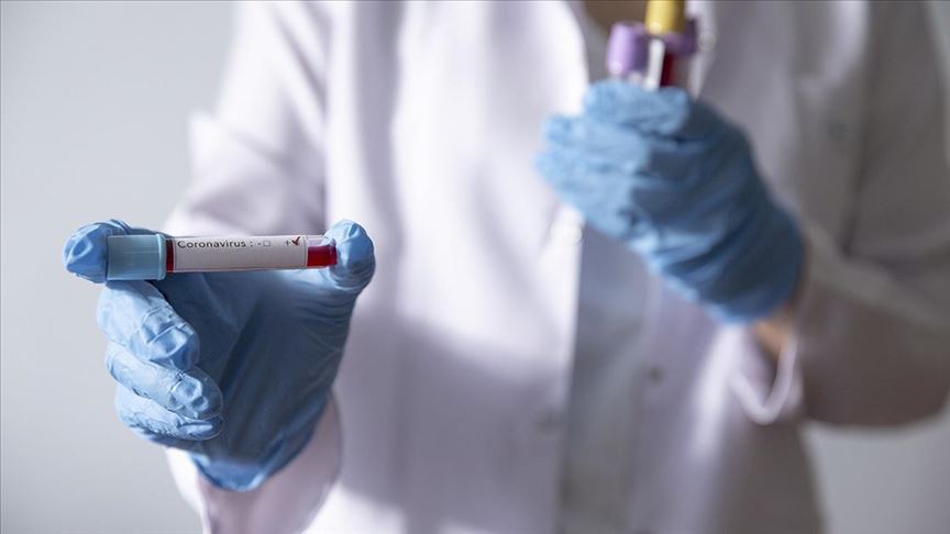 Bursalı bir vekil daha koronaya yakalandı