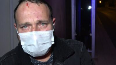 Bursa’da kıskançlık krizi! ‘Karım tarafından darp edildim’