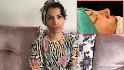 Burun estetiği hayatını kabusa çevirdi! 2 kez canına kıymaya çalıştı