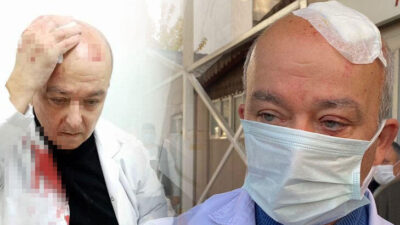 İzmir’de akılalmaz olay! Doktorun kafasını taşla yardılar