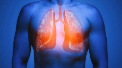 Korkutan uyarı: Dünyada ölümler artacak!