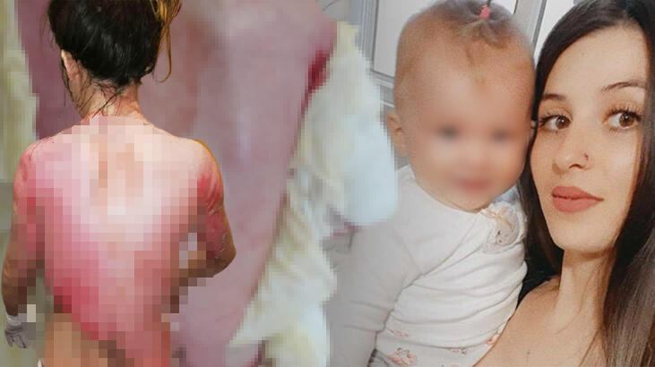 Kan donduran olay! 1,5 yaşındaki kızıyla eşinin üzerine kaynar su döktü, serbest bırakıldı