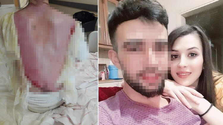 Eşini ve 1,5 yaşındaki kızını haşladı: Kazara oldu Eşini ve 1,5 yaşındaki kızını haşladı: Kazara oldu