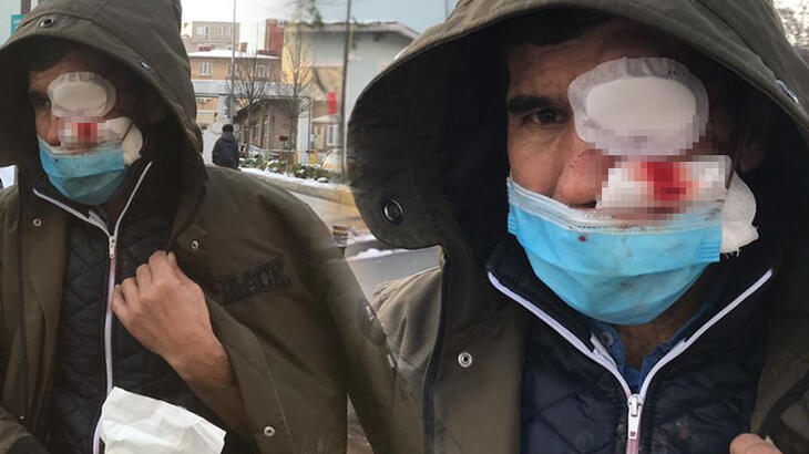 Binadan üzerine buz sarkıtı düşen kişi yaralandı!