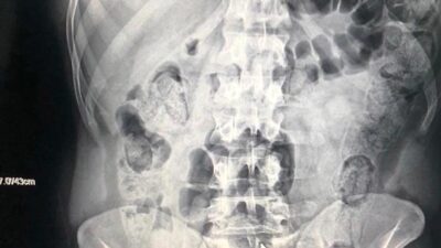 Yolcu kılığına girdiler! Hepsi midelerinden çıktı